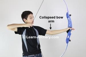 Collapsed bow-arm