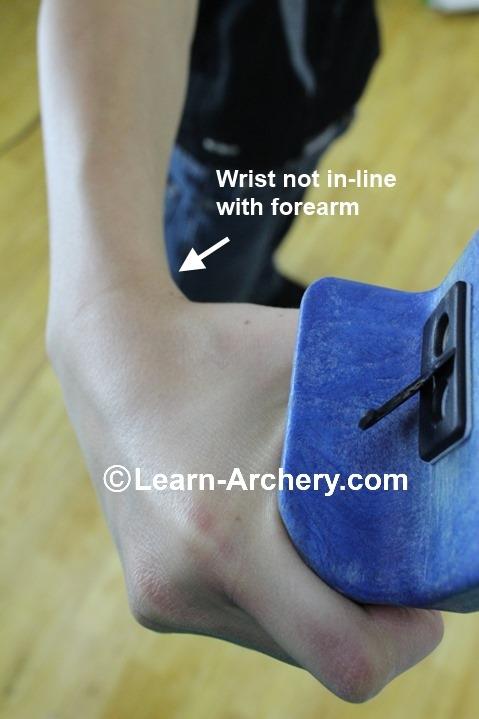 wrist out of alignment with the forearm